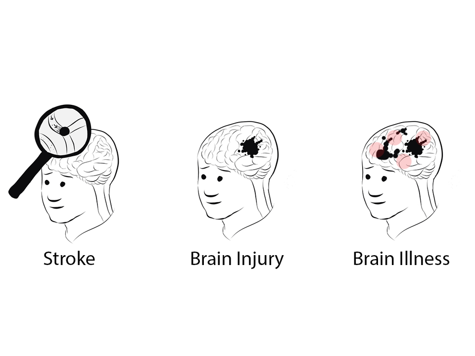 Stroke, Brain Injury, Brain Illness can all cause aphasia